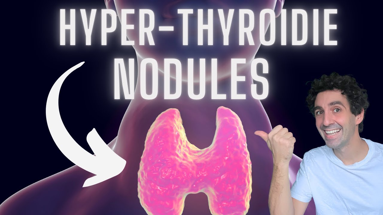HYPERTHYROIDISM: symptoms, causes, treatments... with an endocrinologist
