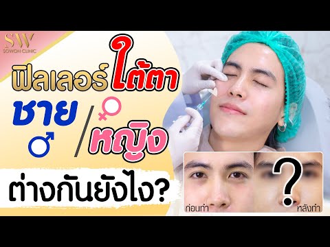 ฉีด ฟิลเลอร์ ปาก