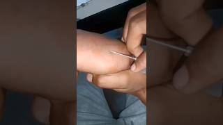 pharma.. motivation.. video.. part 1074 #shorts #cannula #viral