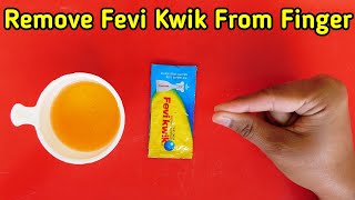 How To Remove Feviquick From Hand Feviquick Remove
