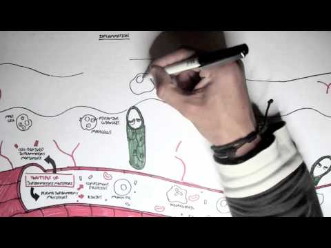 Nociceptors An Introduction to Pain