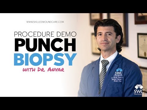 Punch Biopsy Demo - Skilled Wound Care