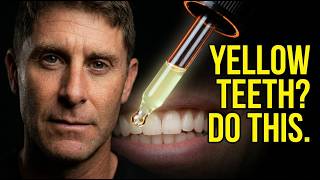 The Real Reason Your Teeth Are Yellow (And How To Fix It Naturally)