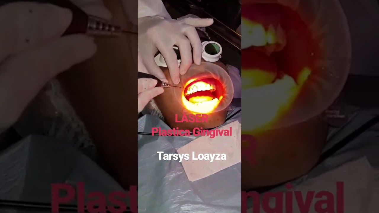 Tarsys Loayza-43