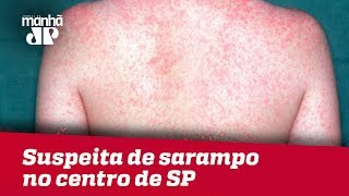 Suspeita de sarampo no centro de SP é motivo de preocupação