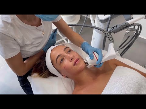 Radiofrecuencia Facial