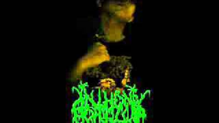Anthony Portillo - Intracranial Parasite (Abominable Putridity Cover)