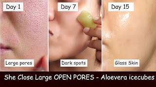 She rubs Aloevera ice cubes Daily & Closed LARGE OPEN PORES | Damaged Skin Repair | Skin whitening