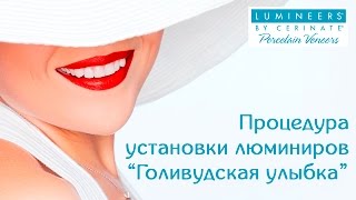 Процедура установки люминиров