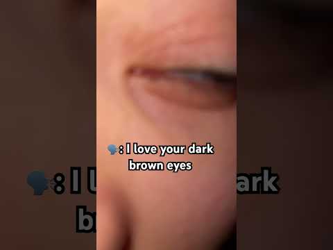 Their actually dark hazel my camera focus is just bad