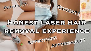 honest brazilian + underarms laser hair removal experience 2021