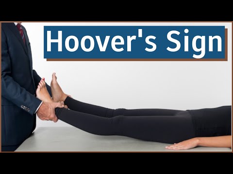 Hoover's Sign | Functional vs Organic Weakness