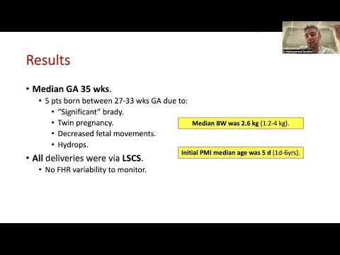 Isolated congenital complete AVB