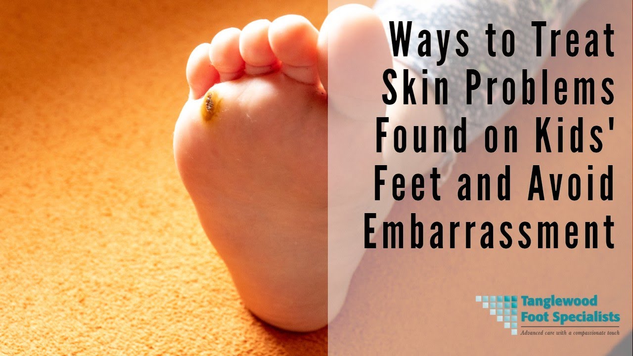 Ways to Treat Skin Problems Found on Kids' Feet and Avoid Embarrassment