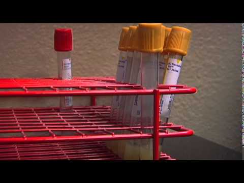 HIV knows no borders