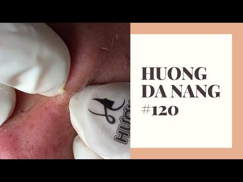 #120 | Huong Da Nang