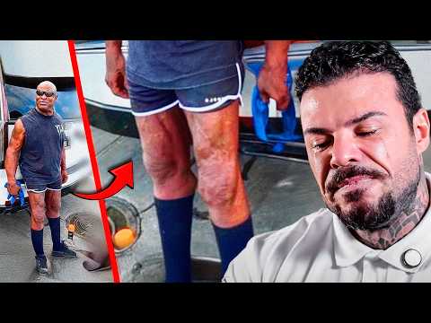 What Happened to Coleman's Legs!