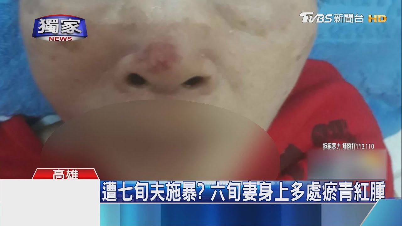 照顧久病妻失耐心? 兒子控父親涉嫌施暴