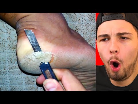 wenn du WOW sagst, starte das VIDEO NEU