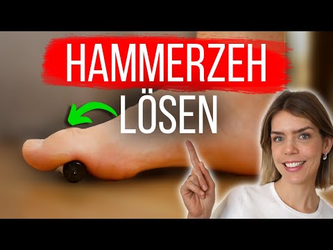 Resolve hammer toe (and prevent it from recurring)
