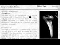 SCP 049 Sounds