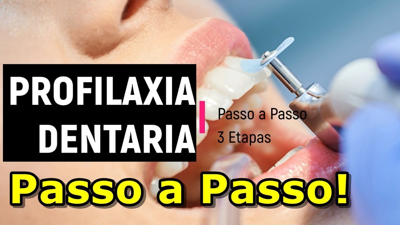Watch Now Profilaxia dental - Passo a Passo Profilaxia dental - Passo a Passo