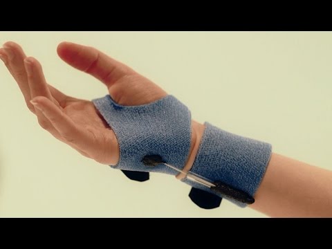 Anti-wrist radial deviation orthosis - Orficast Instructional Movie 17