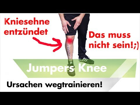 Beseitigen Nackenschmerzen Als können Sie die zervikalen Osteochondrose Massage