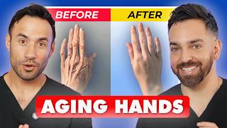 The Ultimate Guide to Hand Care for Aging Hands