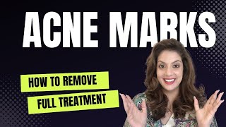 Acne marks removal at home I Pimple marks treatment I Dark spot on Face I PIH PIE | NIPUN KAPUR