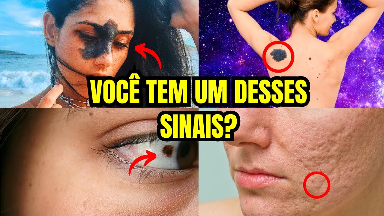 Descubra o Sinal Único que Apenas os Destinados à Grandeza Possuem