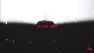 Music video thumbnail preview for THE CANYON OBSERVER Lacerations / Neon Ooze [Afterparty RŠ] by The Canyon Observer