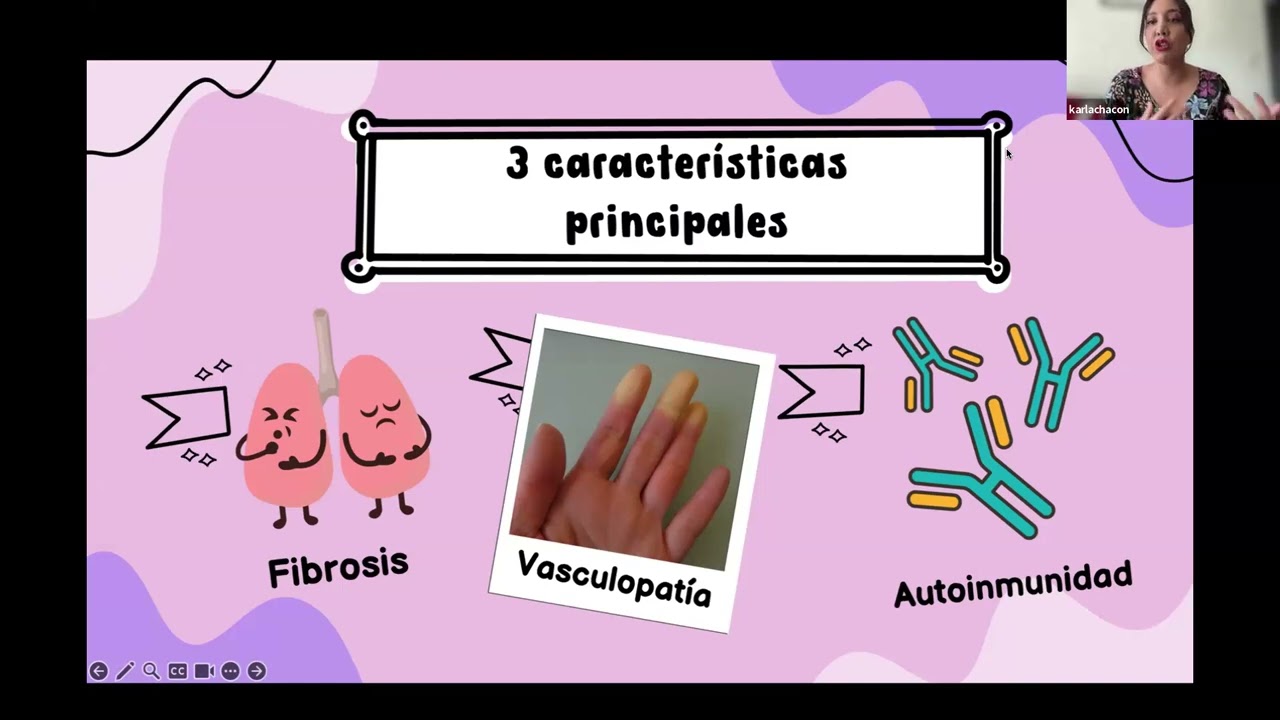 ¿Qué es la Fibrosis Pulmonar?