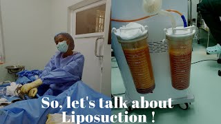 Liposuction and Fat transfer // Types of liposuction  // 5 things you should know about liposuction.