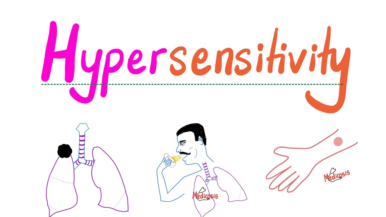 Hypersensitivity Reactions (Type I, II, III, IV HSN) | Most Comprehensive Explanation!