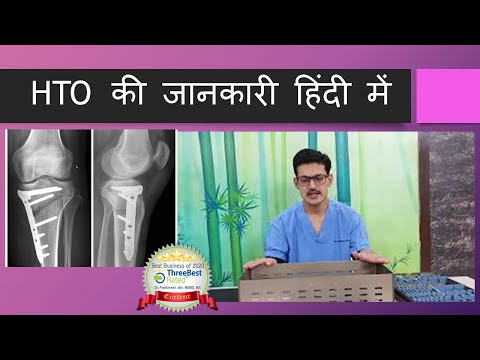 HTO(High Tibial Osteotomy in Hindi)