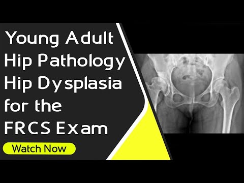 Young Adult Hip Pathology