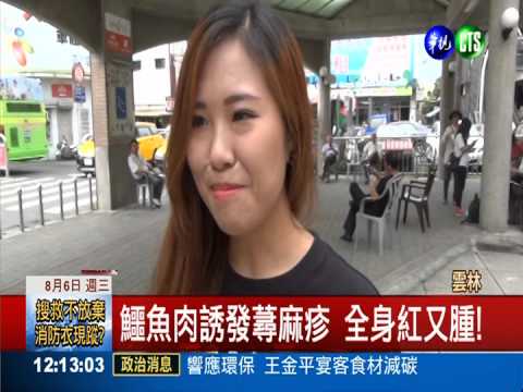 吃鱷魚肉過敏 正妹長出"鱷魚皮"?