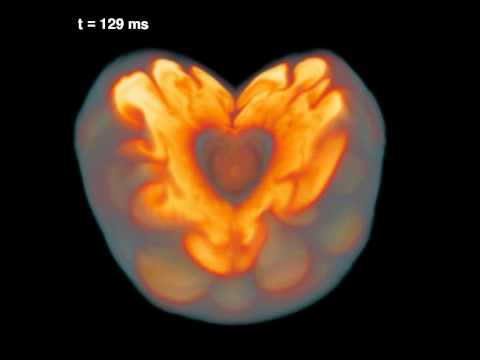 Supernova explosion: Computer simulation of the first 500 milliseconds