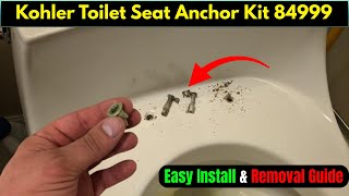 Kohler Toilet Seat Anchor Kit 84999 (Easy Install & Removal Guide)