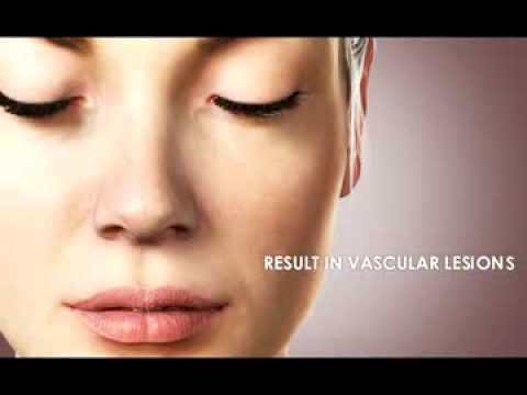 comment traiter erythrose