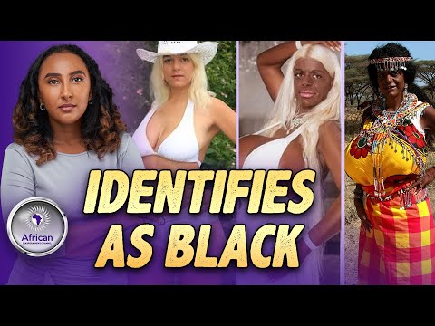 White Model Who Identifies As BIack After Having Tanning Injections Announces Move To Africa