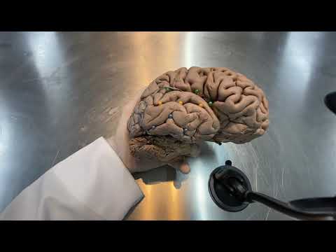 Giros e Sulcos do Telencéfalo - aula prática