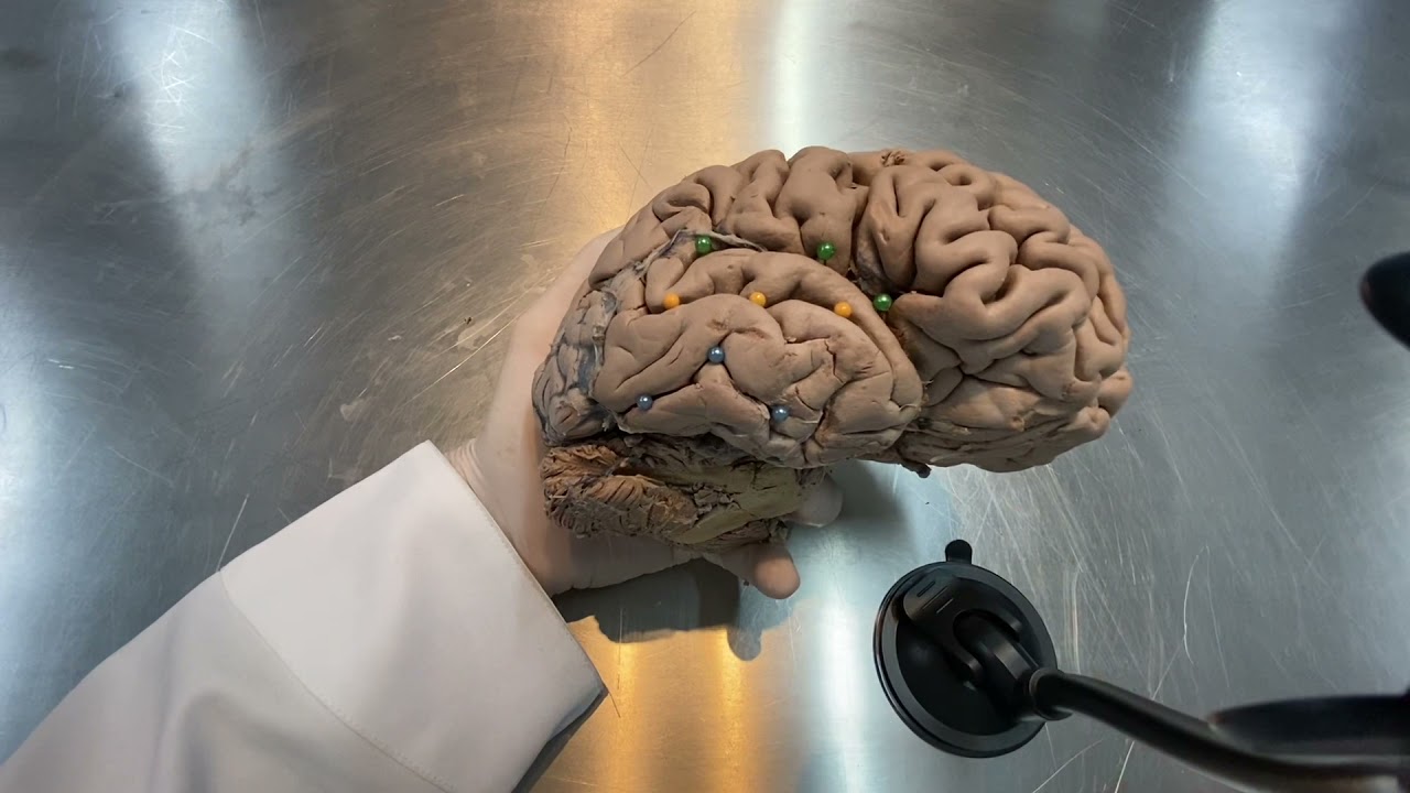 Giros e Sulcos do Telencéfalo - aula prática