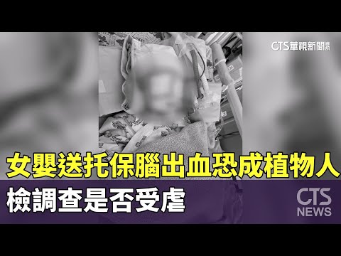 女嬰送托保「腦出血」恐成植物人　檢調查是否受虐