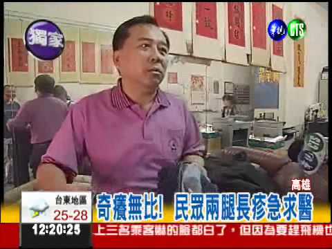 穿大賣場牛仔褲 兩腿紅疹抓不停