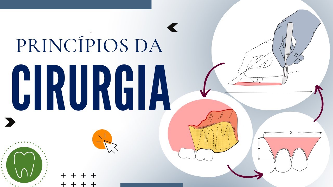 PRINCÍPIOS DA CIRURGIA | Incisão, retalhos, manipulação de tecido