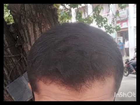 Mintop forte solution, 5%