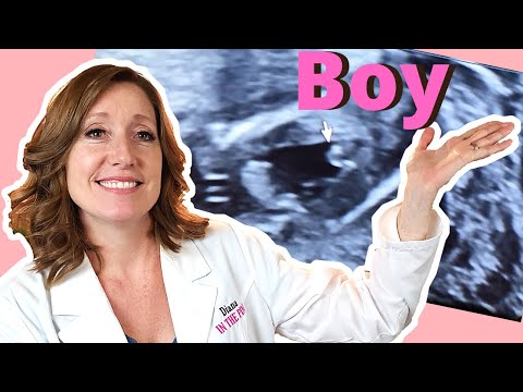 14 weeks Pregnant in Months | What You Need to Know