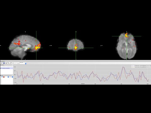 OSU Workshop, Part 3: History of Functional Connectivity